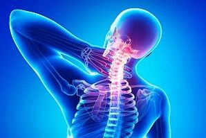 bolesť chrbta ako symptóm osteochondrózy
