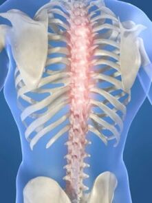 spinálna lézia v prípade hrudnej osteochondrózy