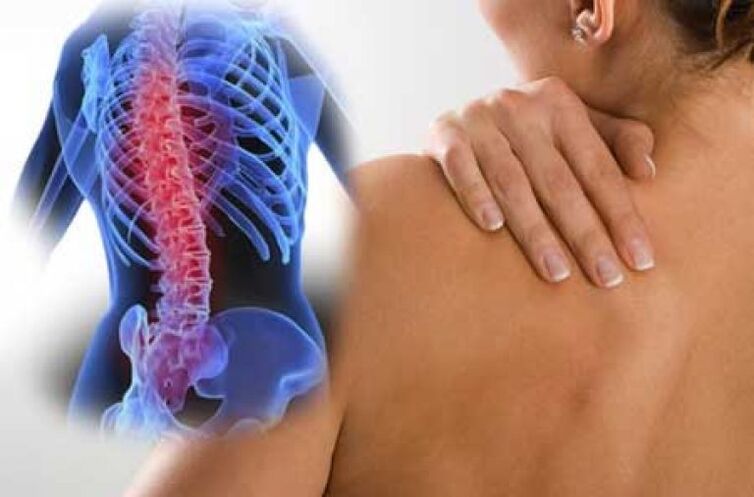 Počas exacerbácie osteochondrózy hrudnej chrbtice sa objavuje bolesť v dorsagu