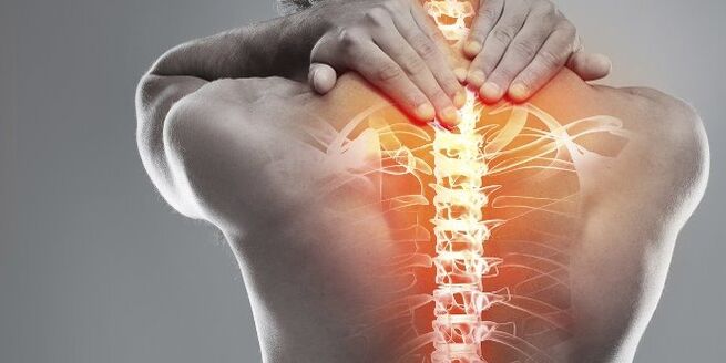 Lekárske možnosti cervikálnej terapie krčnej osteochondrózy