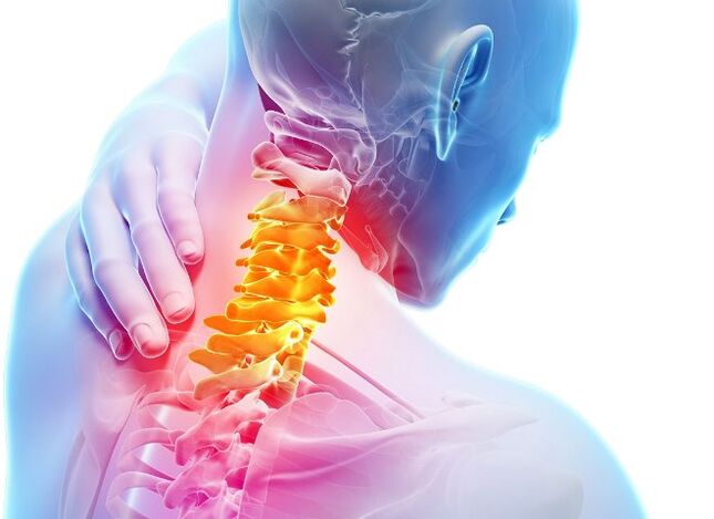 Príznaky a štádiá vývoja krčnej osteochondrózy