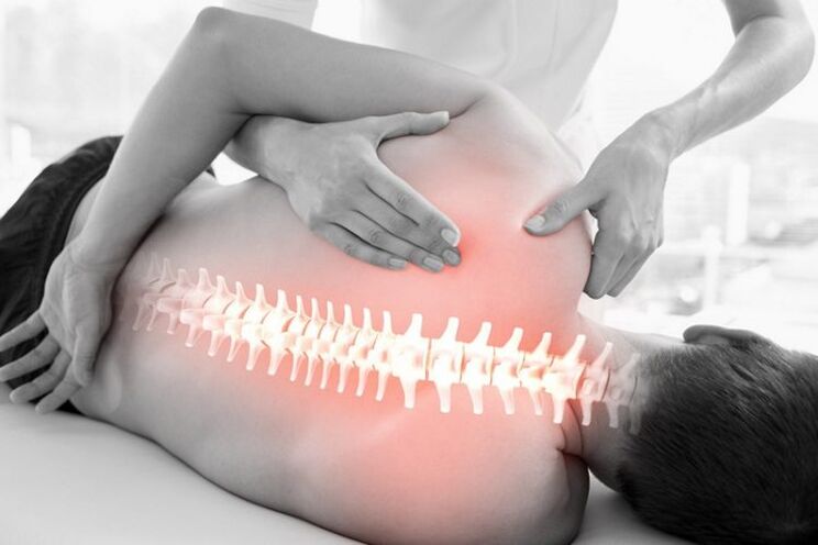 Manuálna terapia osteochondrózy hrudnej chrbtice